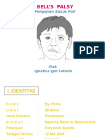 Bell's Palsy Sinistra