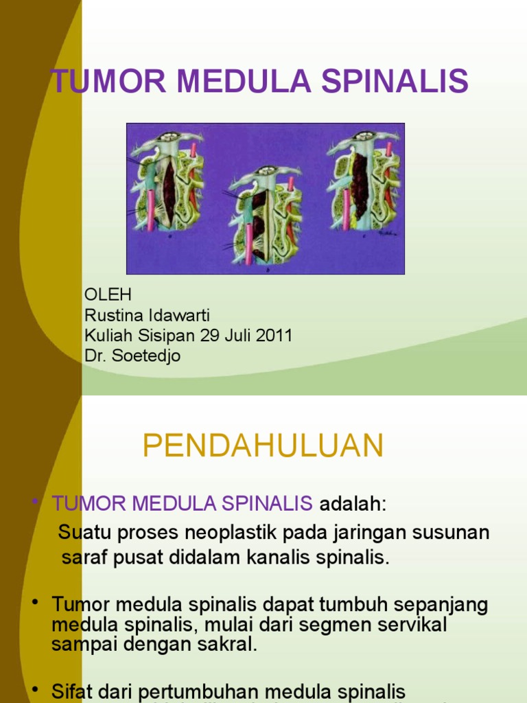 Tumor Medulla Spinalis DR Rustina | PDF | Sains & Matematika