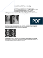 Mediastinal Germ Cell Tumor Imaging