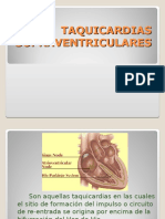 Taquicardias_supraventriculares