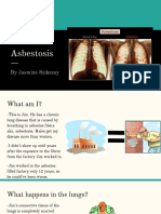 Asbestosis