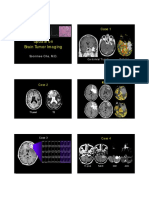 22 Cha Brain Tumor Imaging