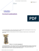 Cervical Laminoplasty - Roush Spine _ Roush Spine