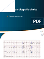 Atelier-ECG-2 Faza Terminala + Diselectrolitemii Brugada