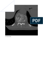 CT Scan Axial