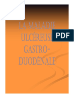 Ulcère GD Et Gastrite_Couleur