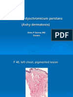  Erythema Dyschromicum Perstans., F 48, Left Chest, Pigmented Lesion.