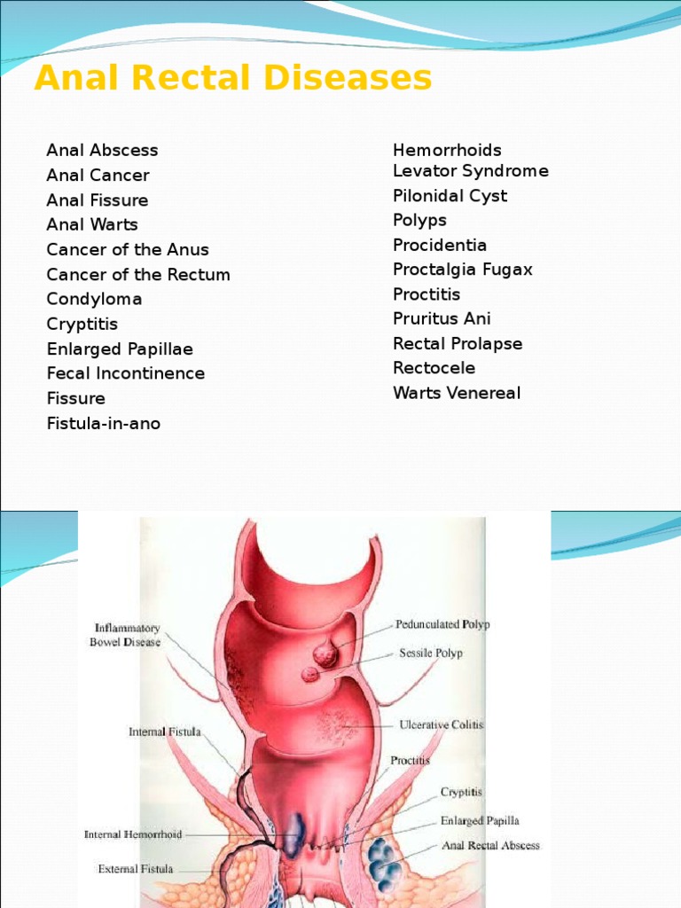 anorectal_dars.ppt Hemorrhoid Rectum Free 30day Trial Scribd