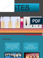 Postes de Protesis Fija PDF