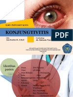 ODS Konjungtivitis