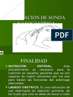 Sonda Nasogastrica