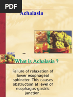 Achalasia