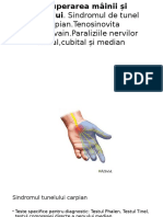 Recuperarea Mainii Și Pumnului Sindromul de Tunel Carpian Tenosinovita DeQuervain Paraliziile Nervilor Radial Cubital Și Median