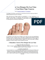 Como Curar Los Hongos en Las Uñas de Los Pies Con Estos Tips Caseros