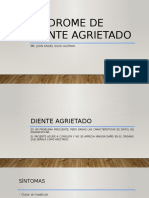 Síndrome de Diente Agrietado