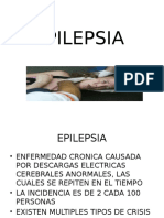 Epilepsia