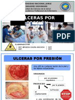 Ulceras Por Presion