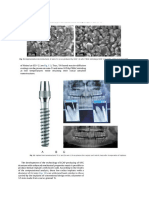 implant dentar.doc