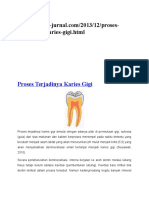 Caries Proses Terjadinya Karies Gigi