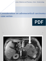 Adrenocortical Carcinoma Case Series