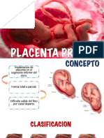 Placenta Previa Obst