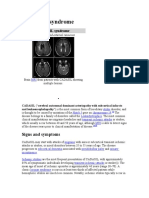 CADASIL Syndrome