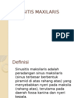 Sinusitis Maxilaris