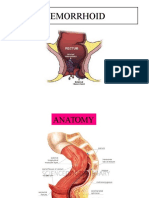 Hemorrhoid