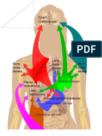Diagram Metastases