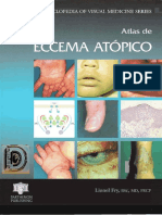Atlas de Eccema Atopico