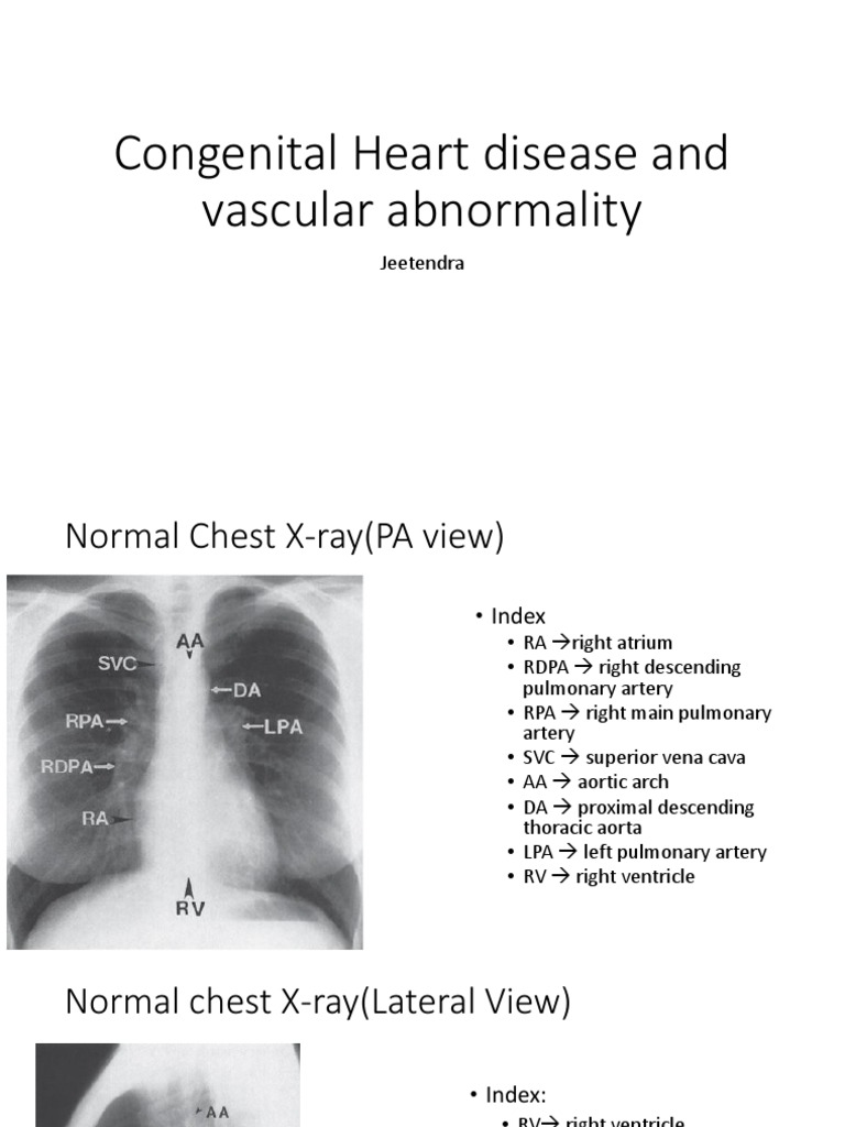Congenital Heart Disease Overview | PDF | Atrium (Heart) | Heart