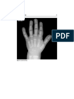 Radiology of Hand