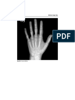 Radiology of the Hand