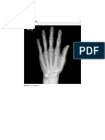 Radiology of the Hand