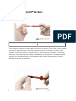 Opalescence Boost Procedure