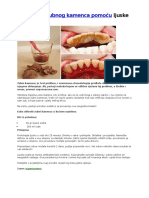 Zubni Kamenac - Jednostavno Uklanjanje
