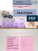 Fractura Listo