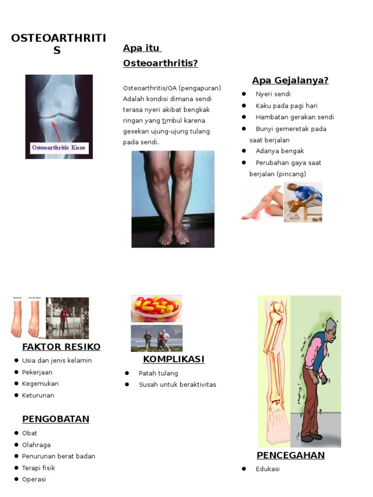 Osteoarthritis (Leaflet) | PDF
