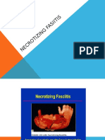 Necrotizing fasiitis.pptx