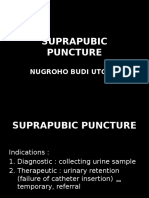 Suprapubic Puncture