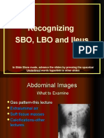 SBO,LBO,Ileus