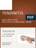 Tendinitis