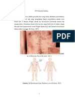 PITYRIASIS ROSEA Sisa Edit DN Pencegahan