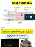 EKG: Lo esencial del electrocardiograma