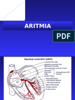 Aritmia