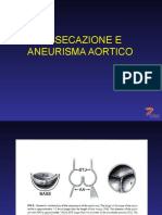 Dissecazione e Aneurisma Aortico