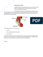 Tendinitis de La Pata de Ganso