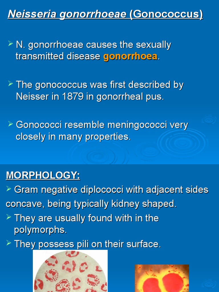 Neisseria Gonorrhoeae | PDF, image size:768x1024