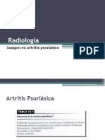 7. Artritis psoriásica