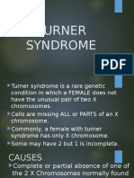 Turner Syndrome